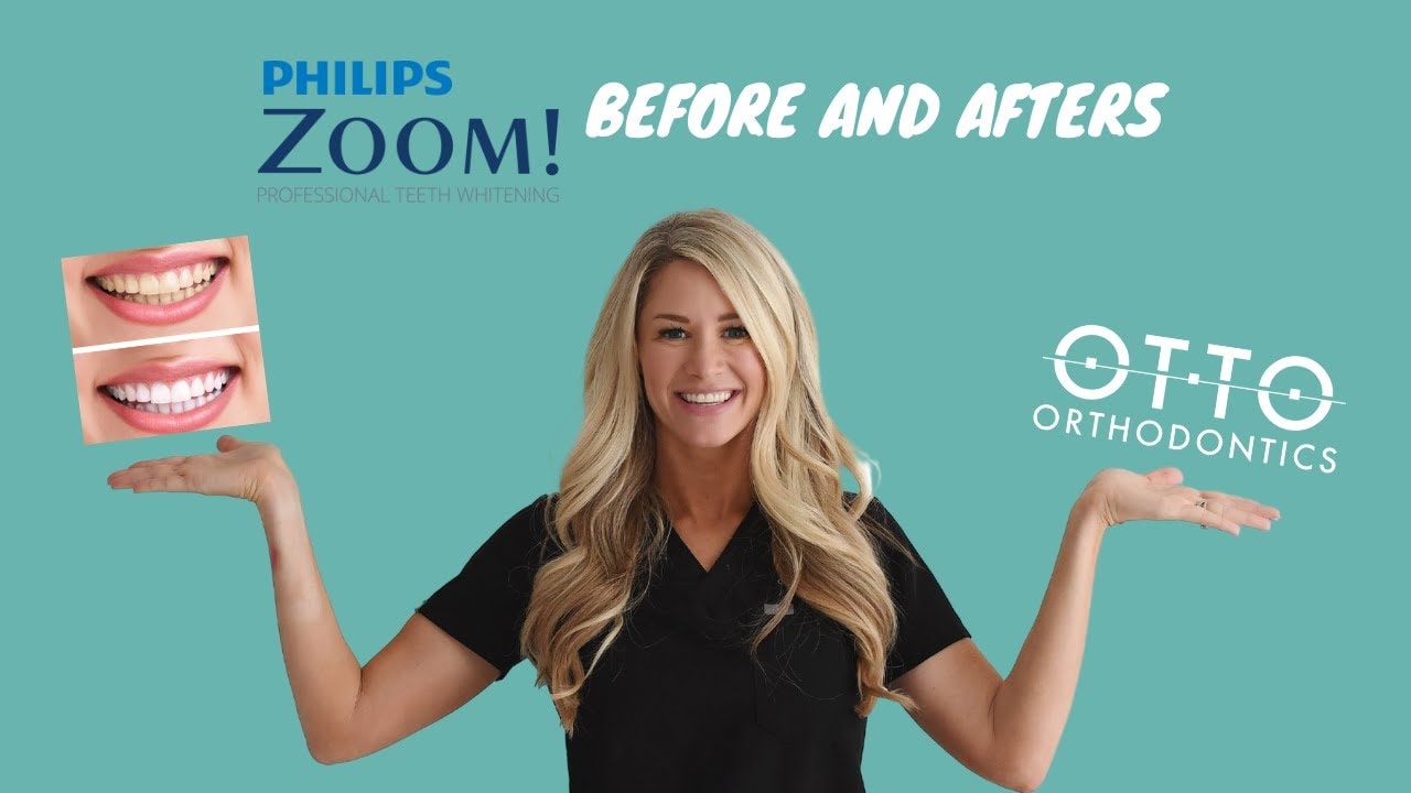 Zoom! teeth whitening with Dr. Otto